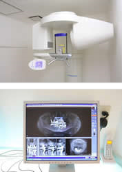 歯科用CTスキャン