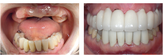 症例2治療前、治療後