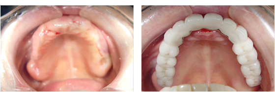 症例2治療前、治療後