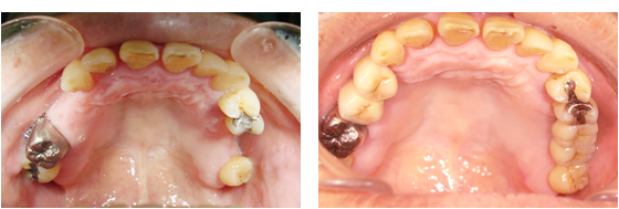 症例4治療前、治療後