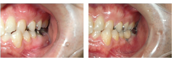 症例5治療前、治療後
